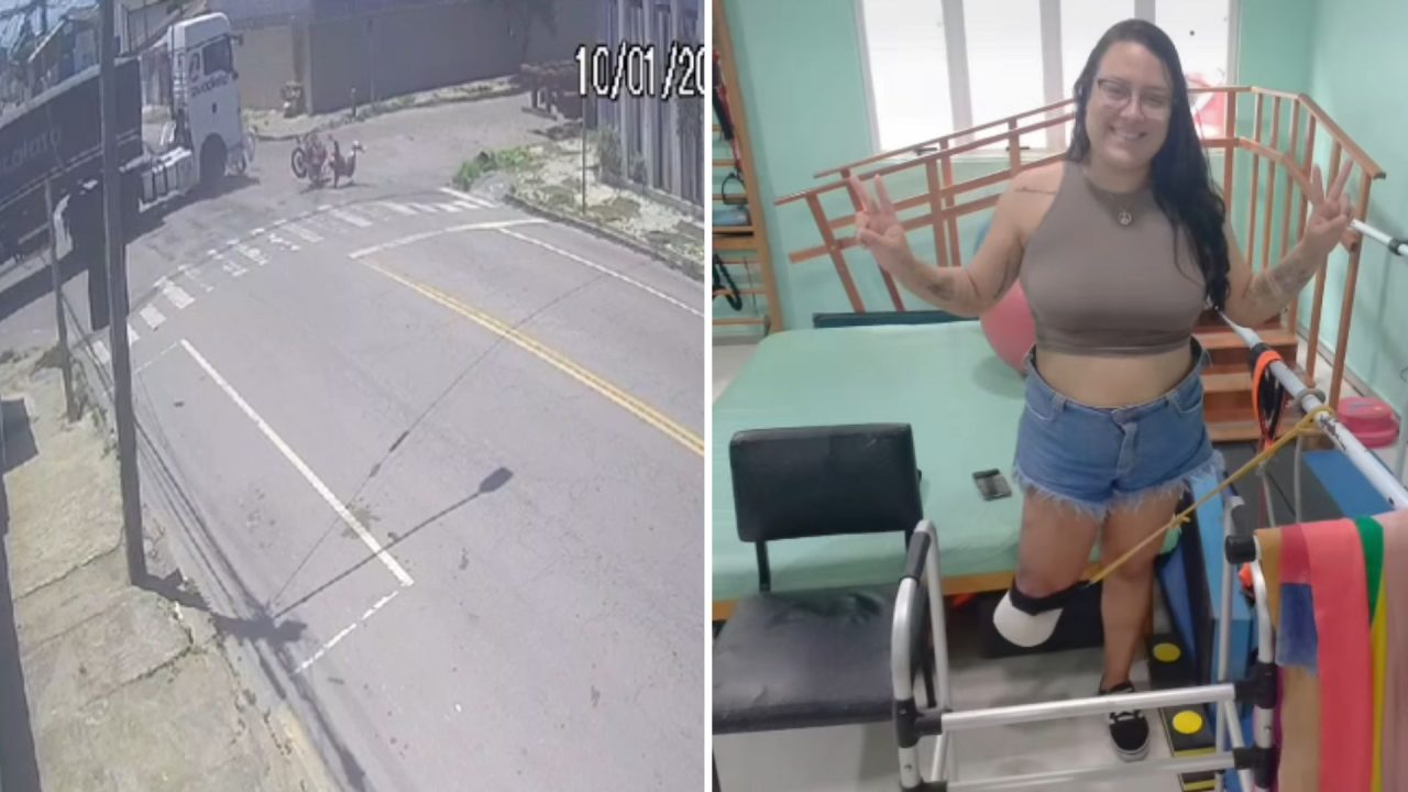 Jovem que perdeu parte da perna em acidente compartilha sua história de superação