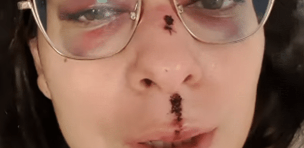 Vítima de acidente de ônibus no RS grava vídeo: 'Hematomas pelo corpo'