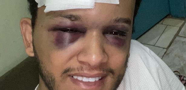 Hugo, da dupla sertaneja com Raphael, sofreu acidente em Mato Grosso do Sul