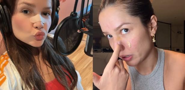 Juliette mostra estado do nariz após fratura