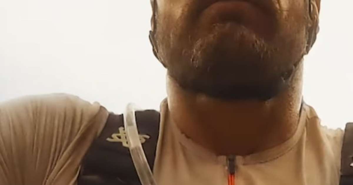 Rodrigo Hilbert sofre acidente na África do Sul e passa por cirurgia; veja vídeo