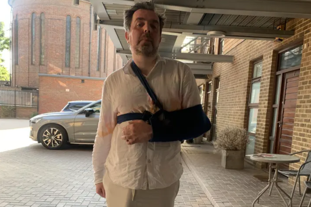 Homem que diz ter o maior pênis do mundo sofre acidente doméstico