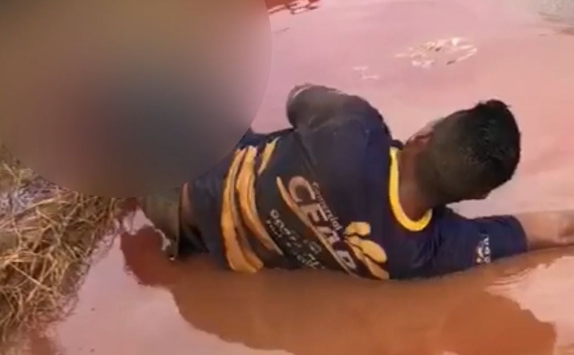 Vídeo de homem com perna amputada em acidente de moto não foi gravado em Roraima