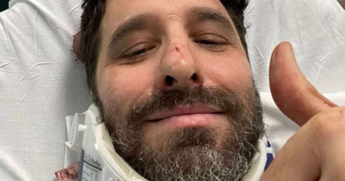 URGENTE! Rafinha Bastos sofre grave acidente e fica desacordado no meio da rua