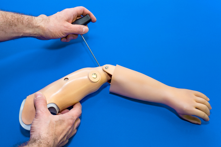 Homem fazendo ajustes em prótese de braço