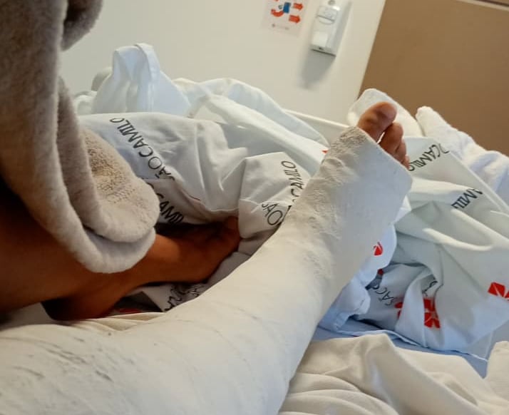 Criança sofre acidente em parque aquático de PG