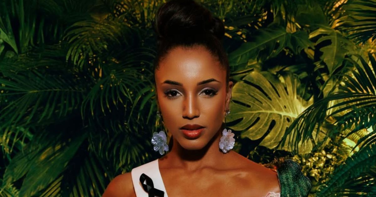 Jamaicana não participou de Miss Universo; relembre acidente grave