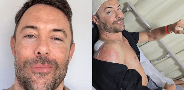 Kayky Brito sofre acidente de bicicleta e admite que não usou capacete