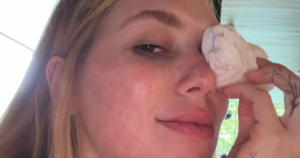 Virginia aparece com lesão no olho após acidente com a filha: ‘Cara toda arregaçada’