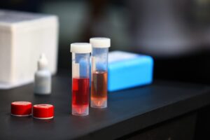 Prefeitura de São José distribui testes para detecção de metanol a comerciantesBand Vale