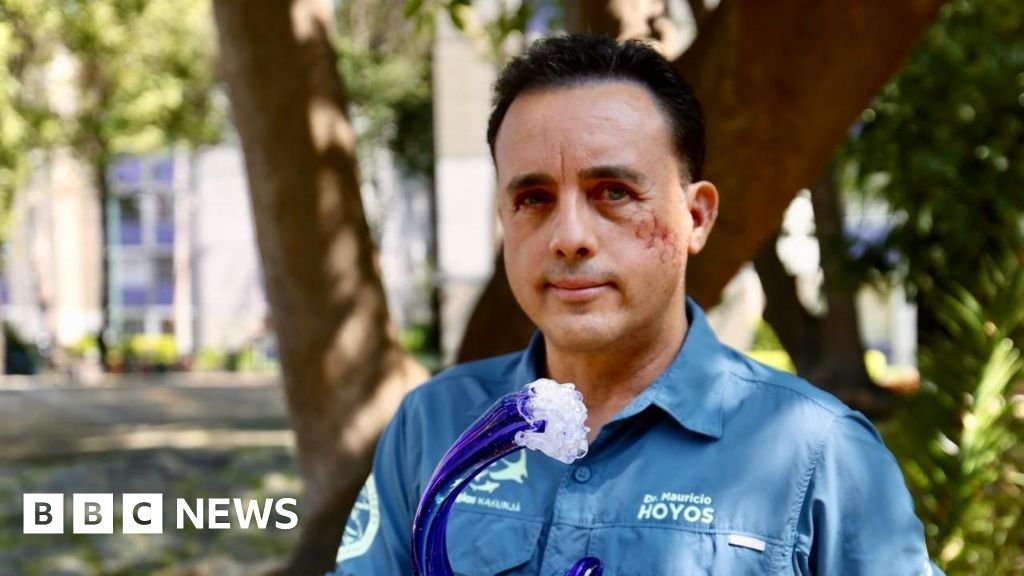 ‘Este animal poupou minha vida’: biólogo mordido na cabeça por tubarão espera encontrá-lo novamente
| cinetotal.com.br