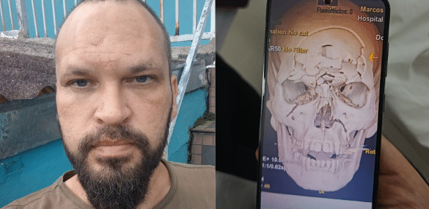 Marcos Ribeiro de Lima, de 40 anos, ficou sem sequelas graves após o acidente