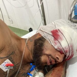 Explosão atinge em cheio o rosto de borracheiro e deixa jovem desacordado em Várzea Grande