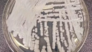 Casos de Candida auris levam bloqueio parcial de área do Hospital da PM em Natal – NOTÍCIAS SOBRE O RIO GRANDE DO NORTE