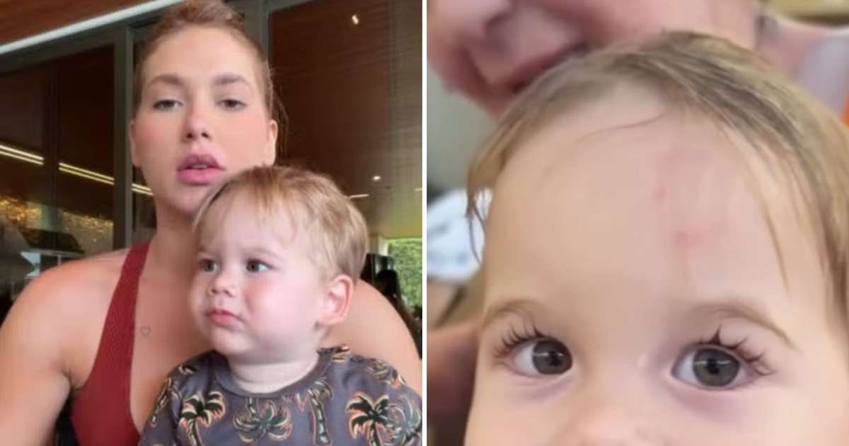 ACIDENTE! Filho de Virginia volta da escola com hematoma na testa; saiba